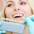 Company Dental Implant in Dubai