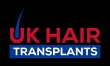 UK Hair Transplant